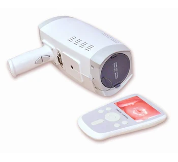 MCL300B a Legtöbb gazdasági könnyen hordozható kézi videó colposcope sok kedvezményes ár